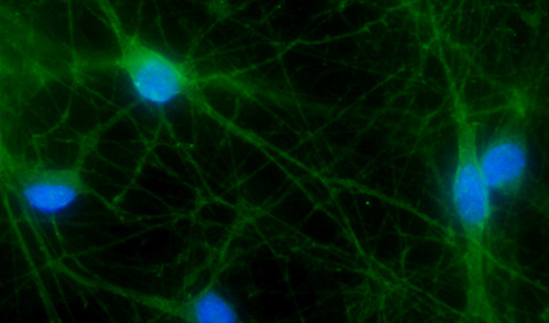 Microscopy image showing human neurons in blue (indicating cell nuclei) and green (indicating mutated protein)