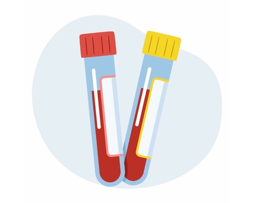 Cartoon illustration of two blood test tubes, one with a red cap and the other with a yellow cap