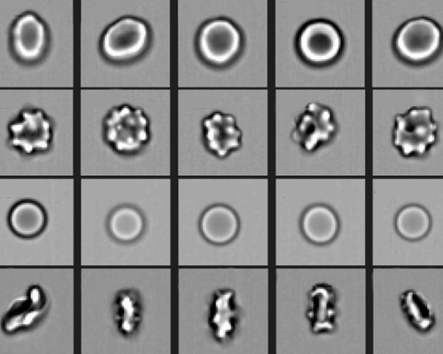 Images of red blood cells such as these were used to train a deep neural network to classify the cells