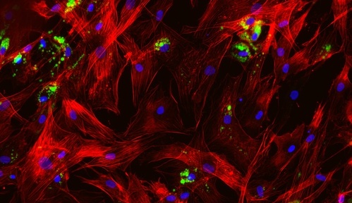 Color fluorescence microscope image of fat cells, aka adipocytes, in which COBLL1 activity has been silenced. The cytoskeleton is dyed red, lipids are dyed green, cell nuclei are dyed blue. Very few green fat deposits are visible.