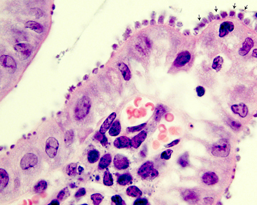 Intestinal tissue infected with Cryptosporidium, with arrows pointing to the parasites.
