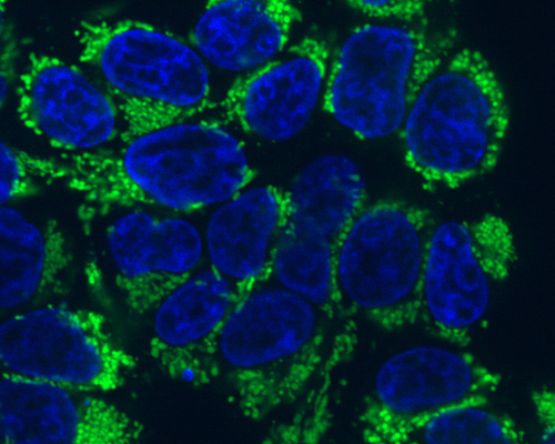 An image of human cells labeled for the frataxin protein (in green), which is insufficient in patients with Friedreich’s Ataxia.