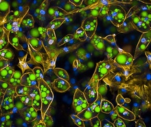 Color fluorescence microscope image of fat cells, aka adipocytes, with functional COBLL1. The cytoskeleton is dyed yellow, lipids are dyed green, cell nuclei are dyed blue. Many green fat deposits are visible.