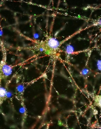 This image shows human neurons (in blue), with the C4 protein (in green) deposited on synapses. 