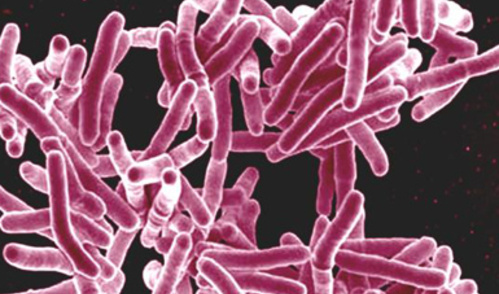 Scanning electron micrograph of Mycobacterium tuberculosis bacteria, which cause TB.