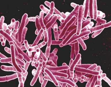 Scanning electron micrograph of Mycobacterium tuberculosis bacteria, which cause TB.