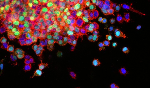 Microscopy image of lung cancer cells shown in bright colors (blue and green)
