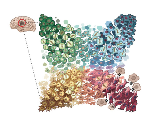 An illustration representing the cellular states of glioblastoma