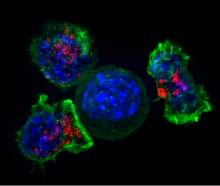 Microscope image of killer T cells surrounding a cancer cell