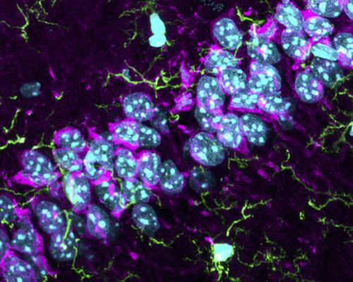 A fluroescent microscope image showing the interactions of complement protein C1q and neurons, shown in purple and blue. C1q is produced by microglia, shown in green and blue.