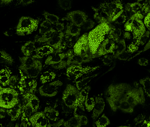 Lipid droplets