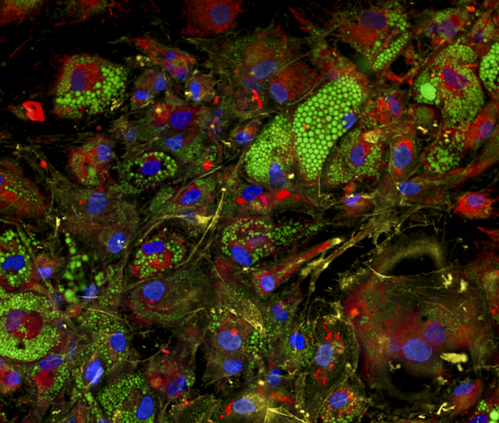 Fat cells, or adipocytes, with stains highlighting nuclei in blue, mitochondria in red, lipid droplets in green, and the actin, plasma membrane, and golgi in yellow.