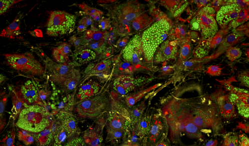 Fat cells, or adipocytes, with stains highlighting nuclei in blue, mitochondria in red, lipid droplets in green, and the actin, plasma membrane, and golgi in yellow.