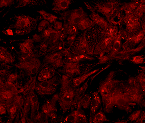 Mitochondria