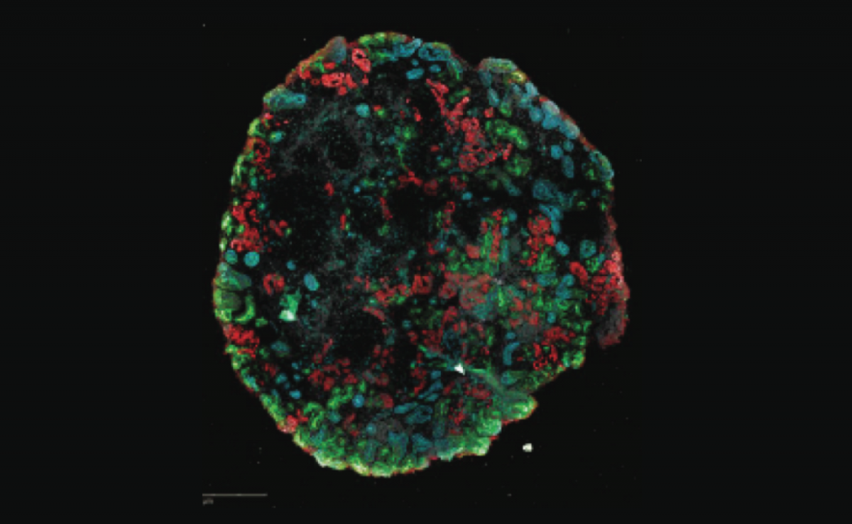 Kidney