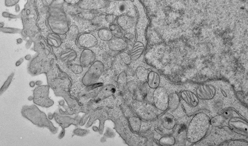 Electron microscopy image of a human hematopoietic stem cell showing hallmarks of ferroptosis, including shrunken mitochondria with fewer inner membrane folds.