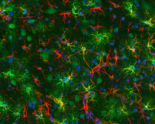 Colorful microscopy image of cells in green, red, and blue.