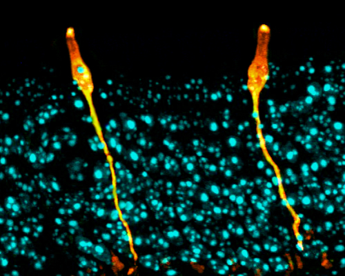 Pulmonary ionocytes (orange) extend through neighboring epithelial cells in the upper respiratory tract of the mouse, to the surface of the epithelial lining. Cell nuclei in cyan.