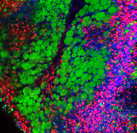 Obesity -  a microscopic view of tissue, showing different cell types and structures within adipose tissue